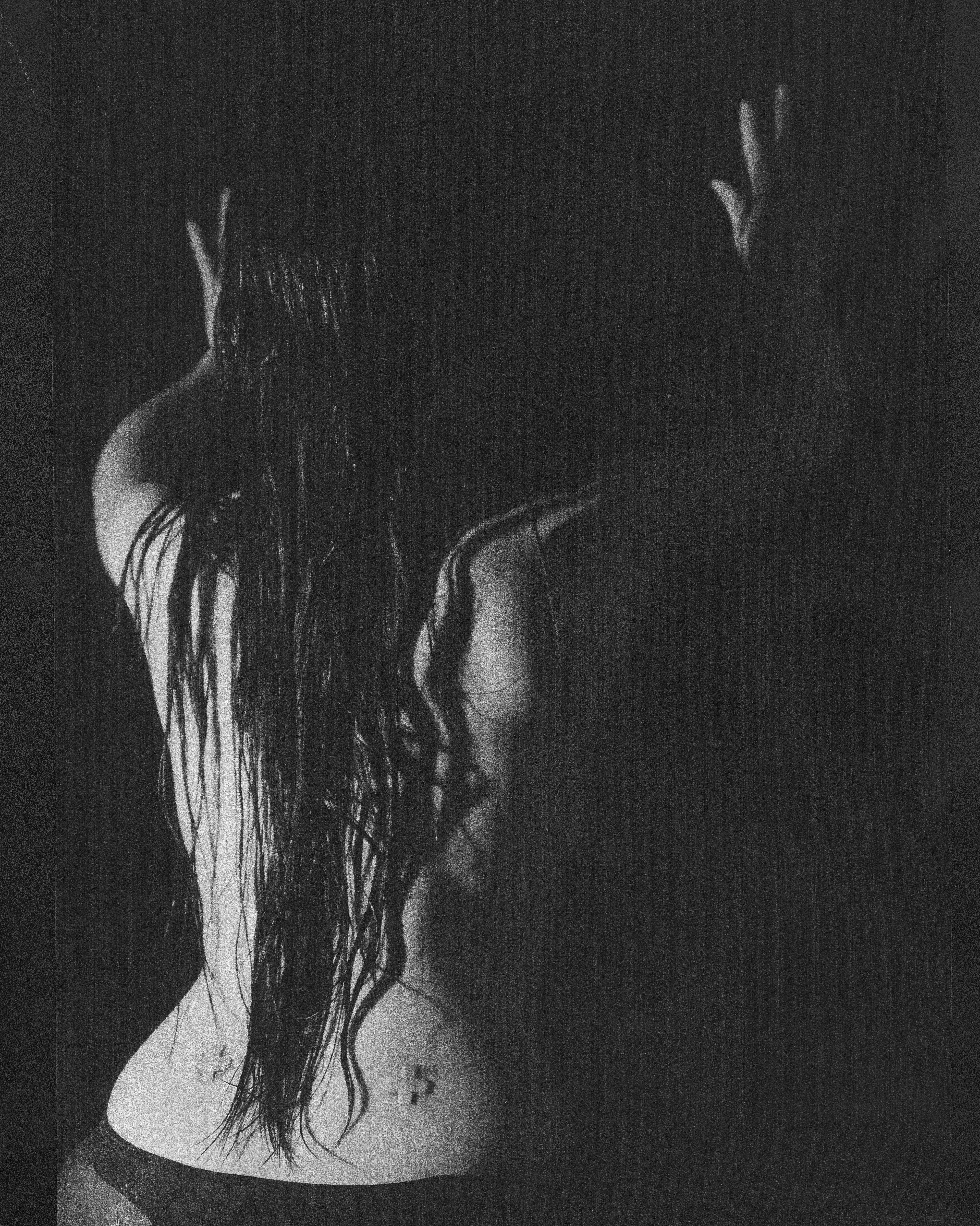 NURSE WITH WOUNDS CROSSES